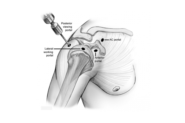 &Alpha;&rho;&theta;&rho;&omicron;&sigma;&kappa;ό&pi;&eta;&sigma;&eta; ώ&mu;&omicron;&upsilon;