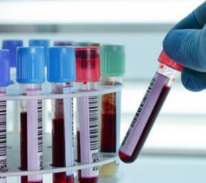 Checkpoint &pi;&rho;&iota;&nu; &tau;&eta;&nu; &epsilon;&kappa;&kappa;ί&nu;&eta;&sigma;&eta;!