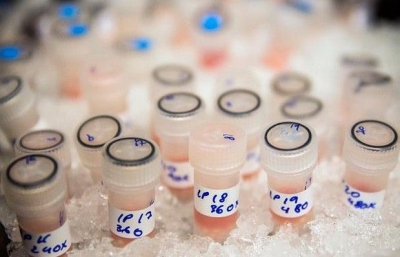 IAAF - &Nu;&tau;&omicron;&pi;έ 28 &alpha;&theta;&lambda;&eta;&tau;έ&sigmaf; &sigma;&epsilon; &delta;ύ&omicron; &pi;&alpha;&gamma;&kappa;ό&sigma;&mu;&iota;&alpha;